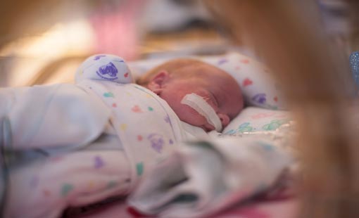 الولادة قبل الأوان