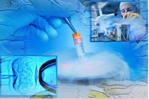 دراسة جديدة : تقدم كبير في التخصيب الاصطناعي