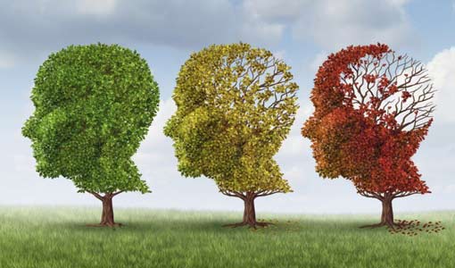 ماذا نعرف عن مرض الـ «زهایمر»