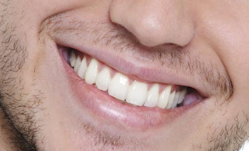 كن مبتسماً.. فهذا من جمال الروح