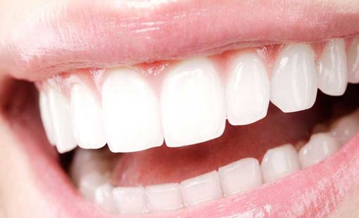 أخطار سوداء تهدد الأسنان البيضاء