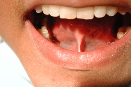 زلة اللسان.. هفوة بسيطة تسبب حرجا كبيرا