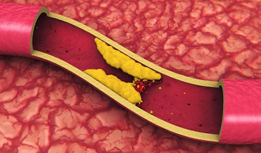 9 حقائق هامة عن الكولستيرول