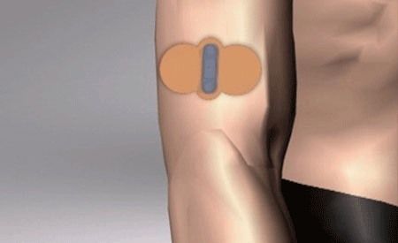 لاصقة كهربائية لعلاج الصداع ومضاعفاته