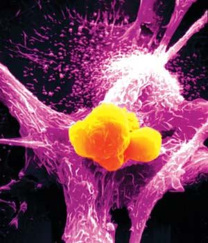 تقنية جديدة لتشخيص أفضل للسرطان