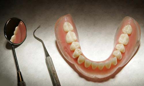 «طقم أسنان» يوقف المرور في مدريد