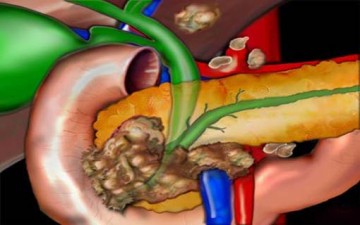 الإعجاز الإلهي في البنكرياس «المعثكلة»