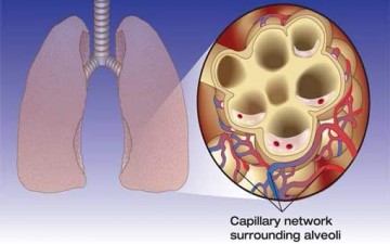 الاستسقاء الرئوي.. ضعف القلب هو السبب