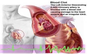 البوتاسوم هام لصحة القلب والشرايين