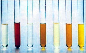 الدم في البول.. ناقوس الخطر