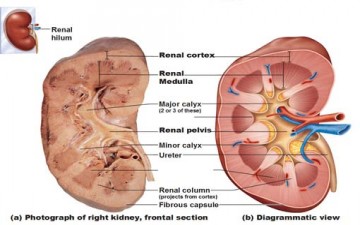 ماذا تعرفون عن حصى الكلية؟