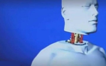 تغيير كبير في أول عملية زراعة رأس بالعالم