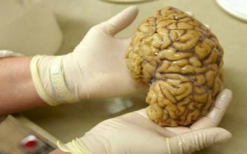 واشنطن تعد لبناء خريطة للدماغ البشري