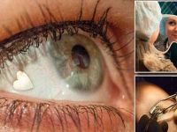 زراعة القلوب البلاتينية في العين.. آخر صيحات الموضة